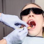 Wisdom Tooth Extraction