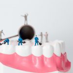 What are your options for teeth fillings?