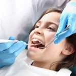 dental sealants for kids